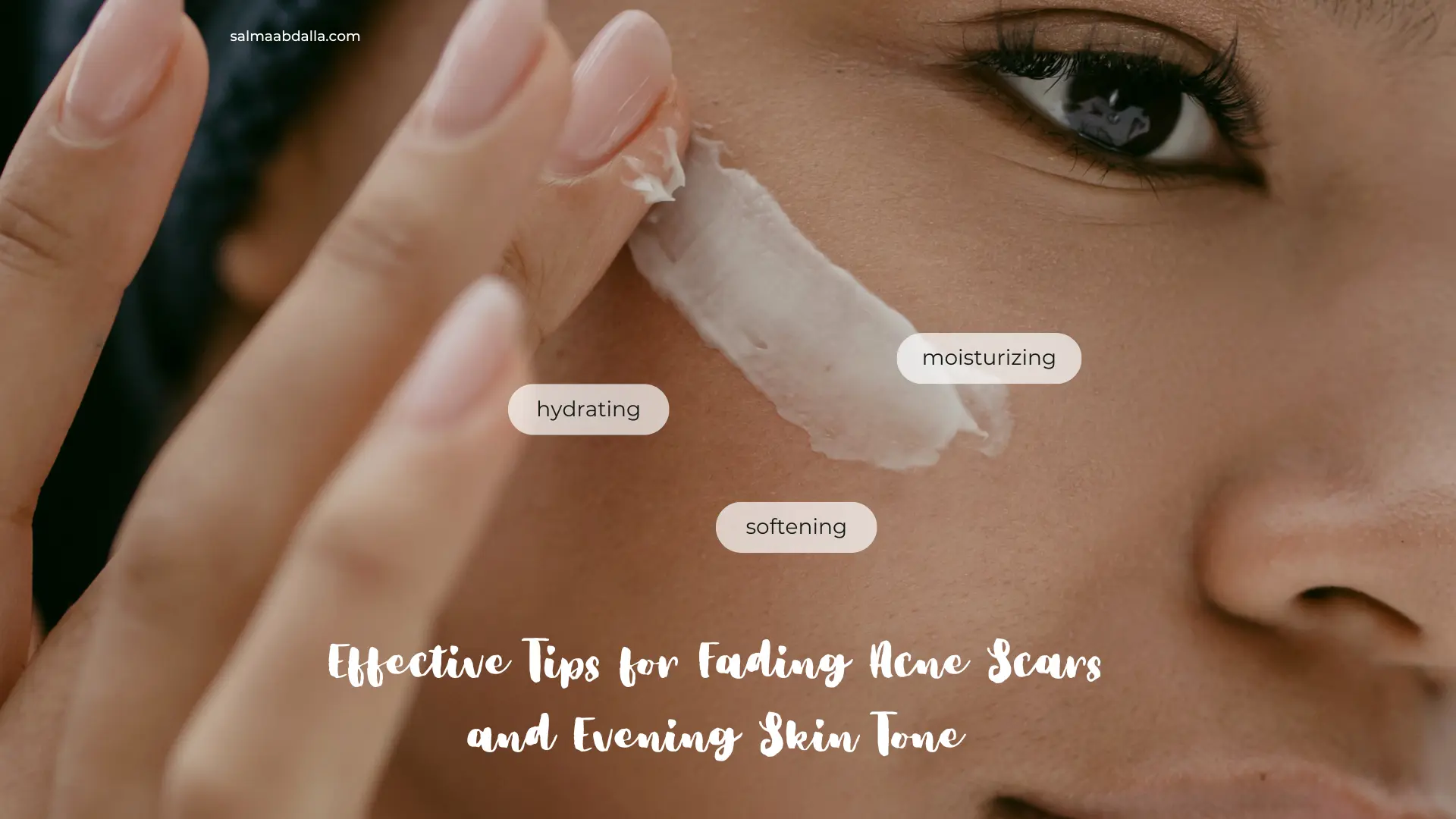 Effective Tips for Fading Acne Scars and Evening Skin Tone