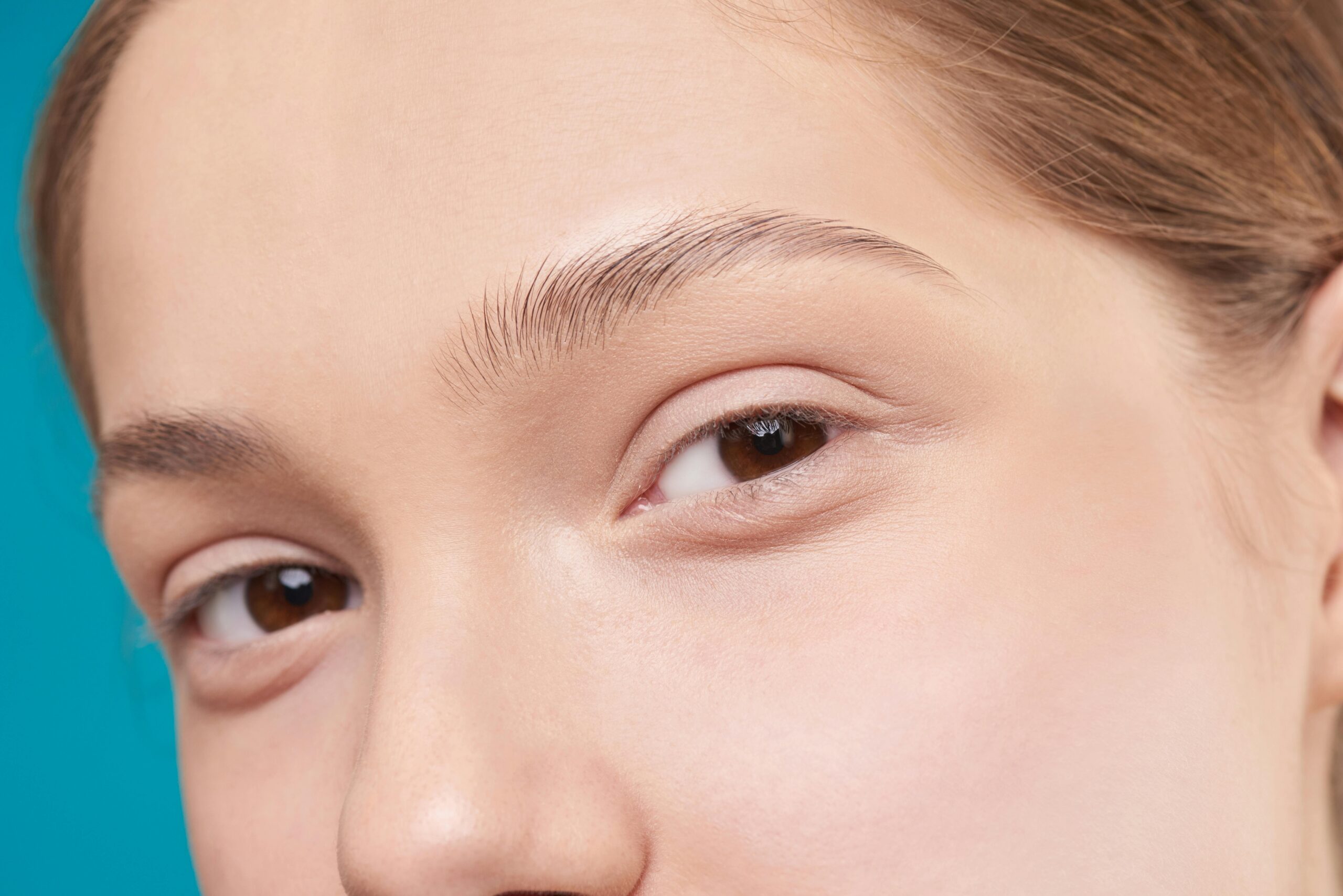 Hyperpigmentation vs Dark Spots: Understanding the Difference and How to Treat Them