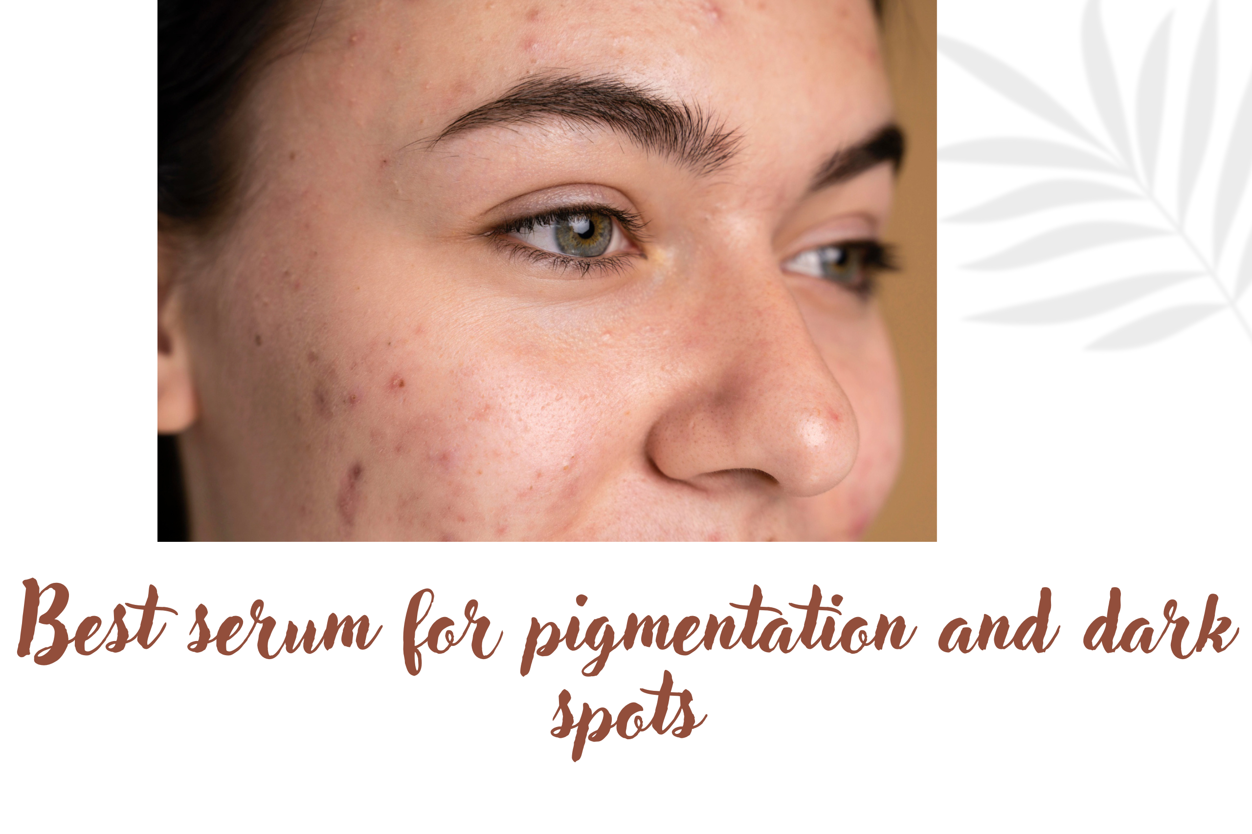 Best serum for pigmentation and dark spots